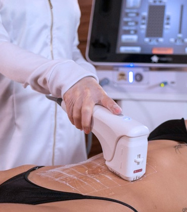 Tratamento estética corporal para alta definição